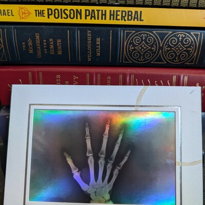 X-ray hand specimen art print