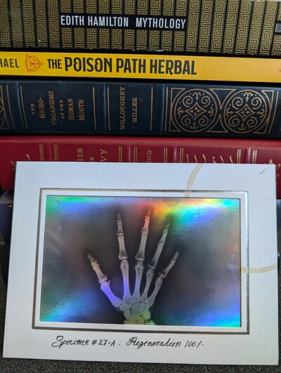 X-Ray Hand Specimen Art Print